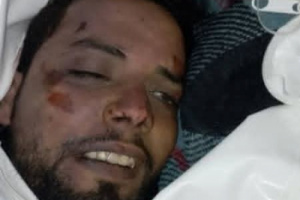 ذبح أسير جريح في وادي حضرموت.. جريمة مليشيات العليمي والإخوان بوحشية لا تقل عن جرائم إسرائيل ضد الأسرى المصريين في 1956-1967