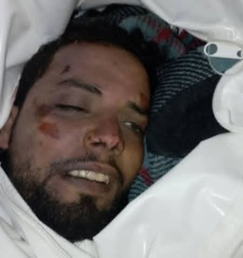 ذبح أسير جريح في وادي حضرموت.. جريمة مليشيات العليمي والإخوان بوحشية لا تقل عن جرائم إسرائيل ضد الأسرى المصريين في 1956-1967