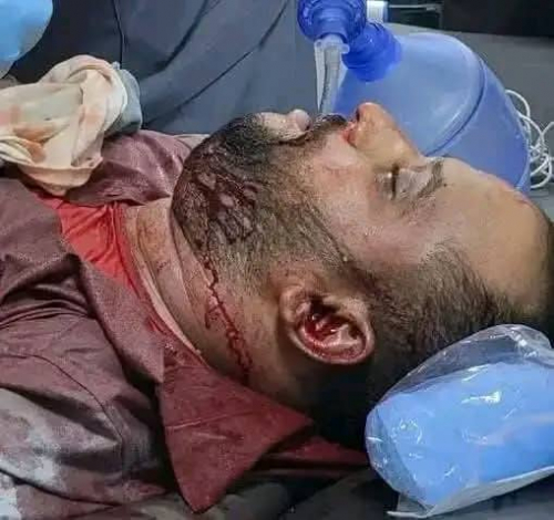 شبوة تشيع الشهيد حمزة عشبة في المصينعة بعد استهدافه برصاص السلطة في عتق (صور)