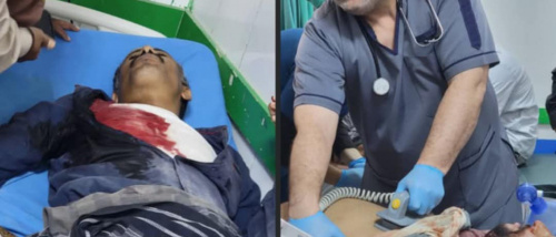 تحطيم منصة الاحتفال في شبوة: دليل على النوايا المسبقة ومجزرة مقززة للمتظاهرين