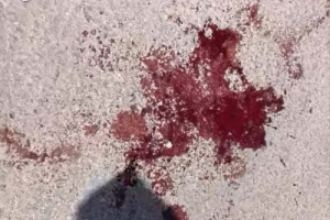 مسؤولية ضحايا الصدام اليوم في تظاهرة عتق.. من يملك السلاح يتحمل تبعات استخدامه