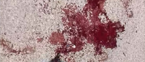 مسؤولية ضحايا الصدام اليوم في تظاهرة عتق.. من يملك السلاح يتحمل تبعات استخدامه