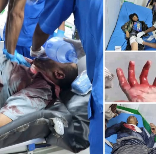 لجنة جديدة للتحقيق في جريمة قتل متظاهري شبوة.. لترميم الحقائق وإطعام البروتوكول!