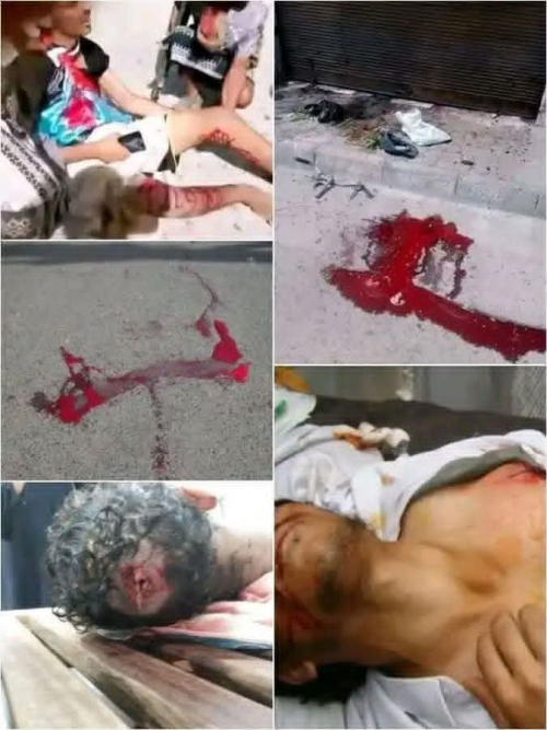 إدانات حقوقية دولية تفتح باب التحقيق في جريمة شبوة وتبعث الأمل للجنوبيين