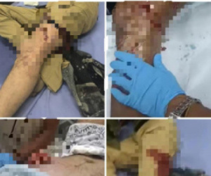 عاجل.. إصابات بين محتجين إثر إطلاق نار قوات الاحتلال اليمني على بوابة معاشيق في عدن (صور)