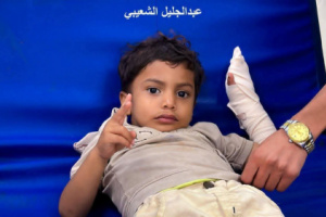 مجزرة معاشيق&hellip; شهيد وعشرون جريحًا بينهم أطفال برصاص درع اليمن في عدن