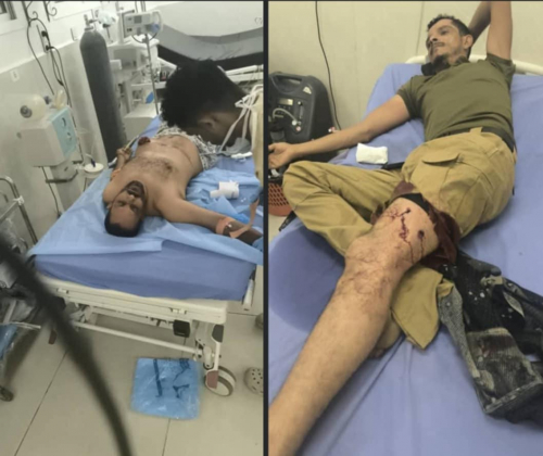 الصحفي ياسر اليافعي: بيان اللجنة الأمنية في عدن يزيد الاحتقان ولا يجيب عن سؤال الرصاص