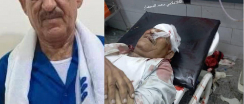  رصاصة مجلس العليمي تقتل المعلم عبدالسلام الشبحي&hellip; دماء المدنيين على طريق المظالم