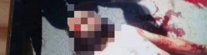 إعدام ميداني لجريح تم أخذه من مستشفى الثورة في تعز ظهر اليوم