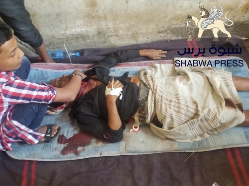 سياسي جنوبي : حزب الإصلاح ينشر الموت و الدمار في تعز