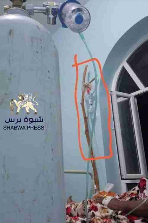 مصدر بصحة شبوة: سلطة بن عديو تتعامل مع كورونا بلا مبالاة