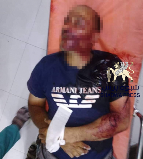 مسلحين يمنيين يهاجمون محل صرافة في شبام ومقتل أحدهم والقبض على آخرين