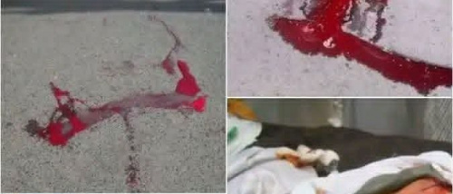 قمع الاحتجاجات السلمية في الجنوب.. انتهاكات ممنهجة بغطاء سياسي