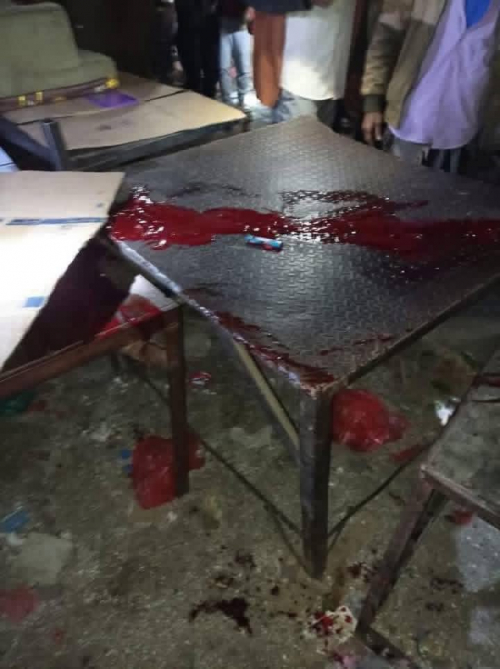 للزج بها في حرب بالوكالة.. شهيد و3 جرحى من قوات دفاع شبوة بهجوم حوثي