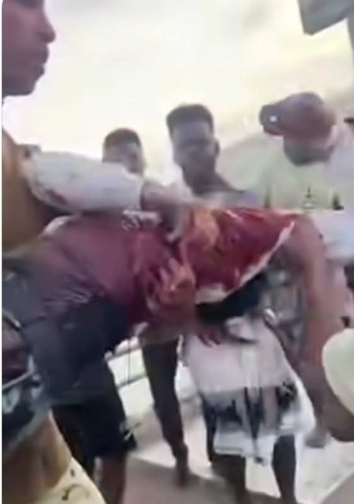 عاجل: مليشيات تكفيرية تقتل الشهيد باجامع وتصيب عشرات المتظاهرين في المكلا (صور)