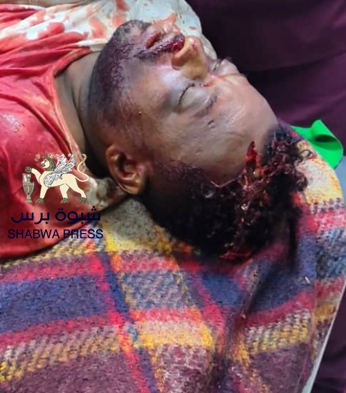 كل أبناء الجنوب ينتفضون غدًا لإسناد حضرموت