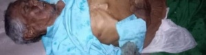 بعد إخراجه عنوه وإلقائه في الشارع.. وفاة رجل مسن في حرم مستشفى عتق العام 