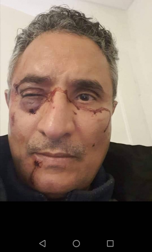 انقذوا "د الريوي" من بلطجية معسكر لجوئه إلى سويسرا قبل فوات الأوان!