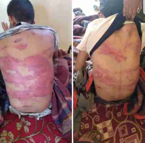 اللجنة الأمنية تؤكد إلقاء القبض على المتهمين بتعذيب و اختطاف ثلاثًة من شباب مديرية جحاف (بيان)