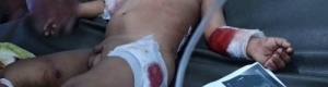 بسلاح التحالف يفتك بأطفال شبوة بقصف مليشيات القتل الإخونجية (صور)