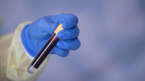 فيروس "كورونا" في برشلونه الاسبانية قبل الصين: عالم بريطاني يقدم رواية مفاجئة بشأن مصدر الفيروس 