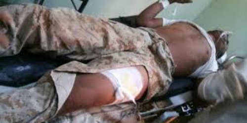 جرحى في اشتباكات بين فصيلين من ميليشيا الحكومة الإخوانية الإرهابية في محافظة أبين 