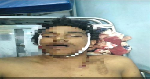 في ظل سيطرة مليشيات شرعية الإرهاب ..متقطعون يغتالون سائق شاحنة في أبين