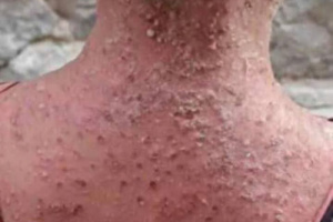 قطع الماء والكهرباء والرواتب عن سكان عدن يهدد حياتهم بالفناء (تقرير)