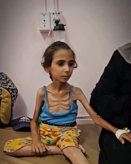 جوع غزة يكشف تواطؤ العالم وسقوط الإنسانية