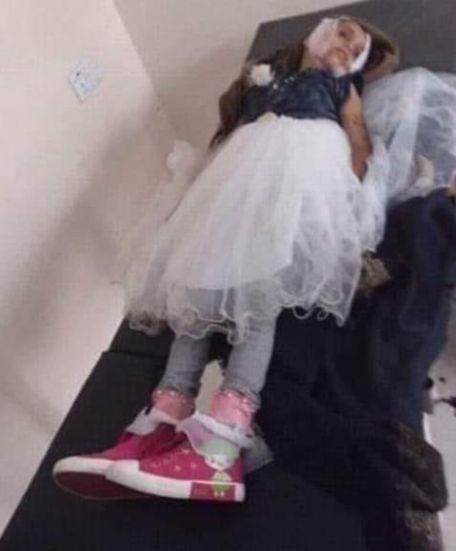 مقتل طفلة صغيرة ببيحان نتيجة لرصاص راجع بأحد الأعراس
