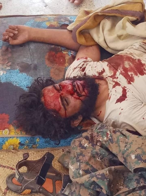 عـاجـل : مقتـل قائد الشرطة العسكرية اليمنية في عرقوب شقرة بأبين 