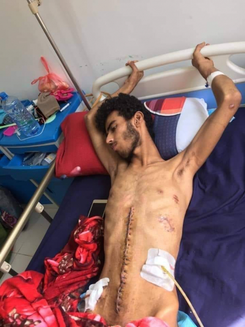 الجنوب خسر الامارات: بعد خروجها وتوقف ملف الجرحى..مناشدات لإنقاذ الجريح عبدالرحمن الضالعي