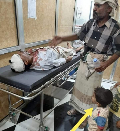 علم الجنوب .. والاعتداء الغاشم على المواطن "أحمد أبوبكر تربش"