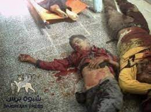 ١٨ محزرة ابادة جماعية قام بها صهاينة الاحتلال اليمني ضد أبناء الجنوب 