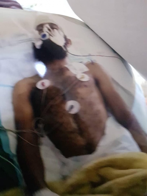 ثاني حالة في 24 ساعة .. وفاة جريح من أبطال قوات العمالقة الجنوبية لعدم حصوله على جواز سفر 