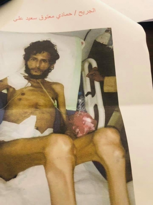 جرائم حرب يجب وصولها للمحاكم الدولية .. حرمان جرحى المقاومة والمرضى من جوازات السفر نتائجه الموت 