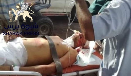 توفير الحماية للمدنيين العزّل في الجنوب من مسئوليات التحالف 