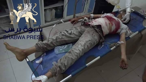 إصابة القيادي المنشق عن الحزام الأمني بأبين "علي مصهرج" إصابة خطيرة في مودية