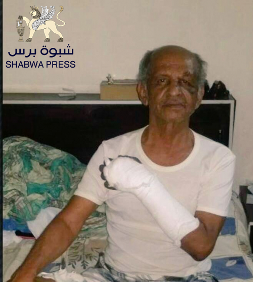 أنصار الله الحوثيين يتكفلون بعلاج الفنان الجنوبي "محمد محسن عطروش"