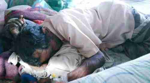 بسبب سياسة التجويع: وفاة  647ضابط جنوبي جوعا ورواتبهم محجوزة