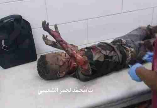 الدول الخمس دائمة العضوية بمجلس الأمن تدين الجريمة الارهابية بالعاصمة عدن