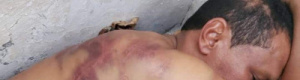 مواطن يتعرض لتعذيب بشع في مسقط رأس محافظ شبوة (صور)