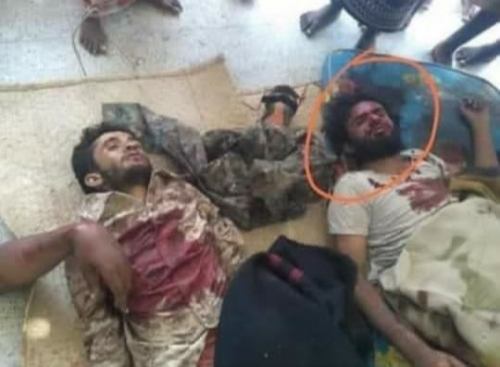 قتلى وجرحى في كمين للمقاومة الجنوبية يستهدف رتلاً عسكريا تابع لمليشيات الإخوان في ضيقة غربي المحفد