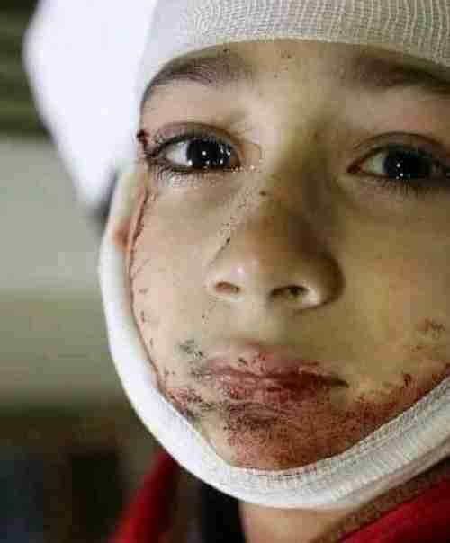 قتل القتيل والسير في جنازته...عدن ومسلسل الدموع والدماء 