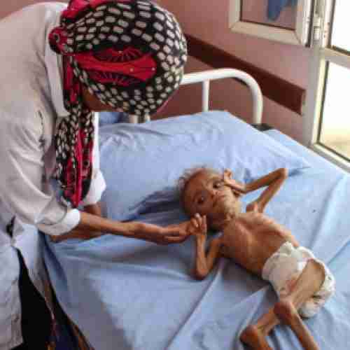  الحرب في بلدي أكلت الأخضر واليابس، رأيت من الناس من يأخذ من براميل القمامة 