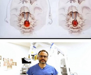 جراح مصري يدهش العالم بأول عملية من نوعها في تاريخ الطب الحديث