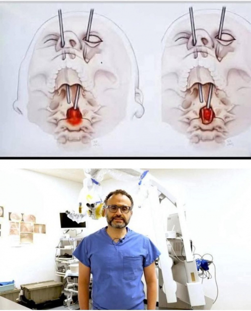 جراح مصري يدهش العالم بأول عملية من نوعها في تاريخ الطب الحديث