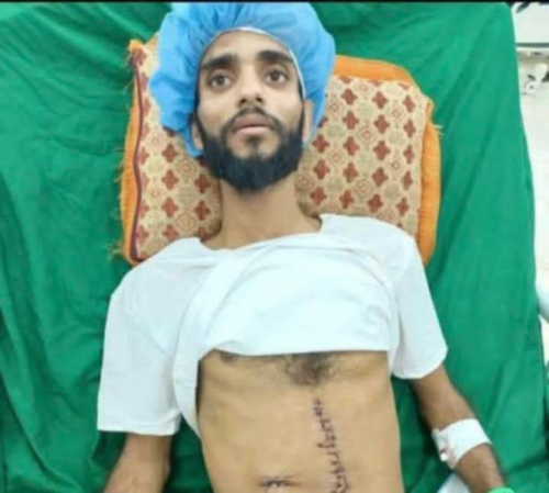 الشرعية تترك جريحًا قاتل 10 سنوات بينما تنفق المليارات على السفلة واللصوص