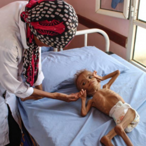 لأول مرة.. منظمة دولية تكشف عن احصائية مخيفة لسكان الجنوب 