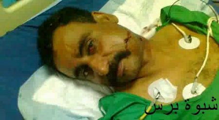 أحد جرحى تفجير لودر يحكي لشبوة برس  تفاصيل الحادث